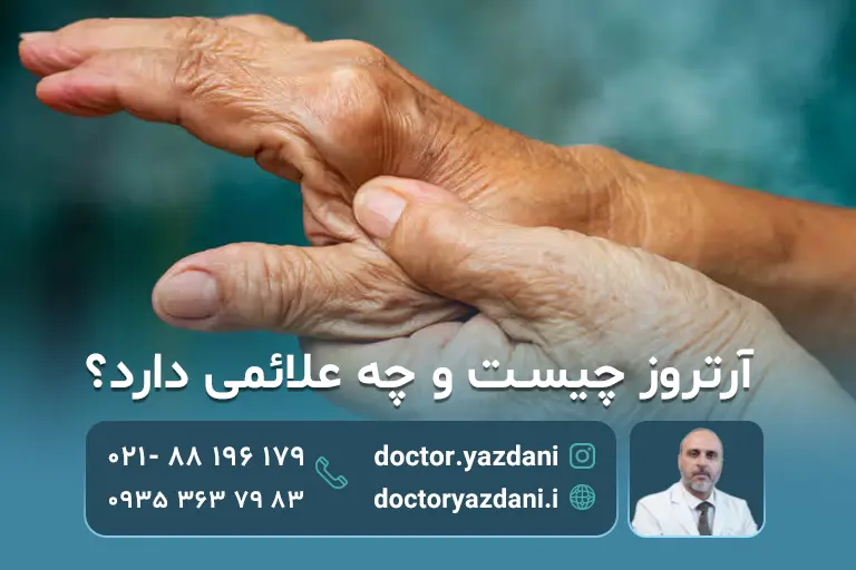 آرتروز چیست و چه علائمی دارد؟